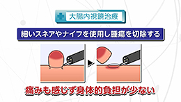 知りたい！がん検診